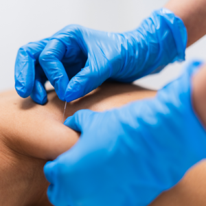 Sesión Punción seca por Zona